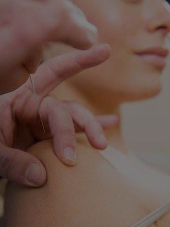 Acupuncture/IMS physiotherapy session with Maggie Scarlett Squamish